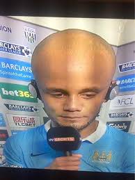 Nathan Gissing] More: Burnley head coach Vincent Kompany is another name