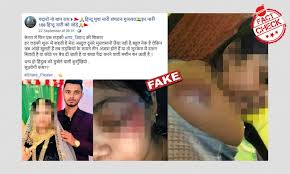 Check spelling or type a new query. Photos Of Bangladesh Domestic Abuse Victim Viral With Communal Spin As Kerala