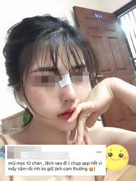 Hành trình làm đẹp 5 năm xót ví của mẹ 2 con: thủng mũi, áp-xe má, đau nhất  chữa nám