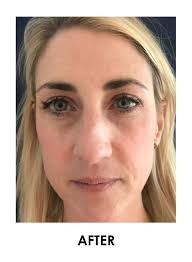 Minki Episode 7 Season 8