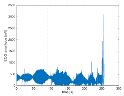 Applied Sciences Free Full Text The Relationship Between Stress Levels Measured By A Questionnaire And The Data Obtained By Smart Glasses And Finger Pulse Oximeters Among Polish Dental Students Html