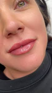 A little before, pre gloss & after gloss lip blush for your Thursday.  Beautiful colour for @sarzjt , -Minimal swelling , -Defined lip shape ,  -Natural colour, -Once the lips have had their 6-8 week ...