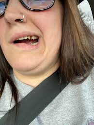 Dentist for CKD patients with safe medication options