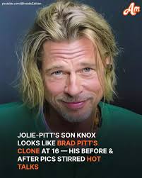 Knox Jolie-Pitt's TRANSFORMATION IN PICS is in the comments.👇