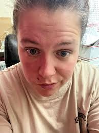 All IVed up and ready to roll. Excited for bypass and a new chapter with  this tool. Edit: thank you everyone for the kind and encouraging words!  Yesterday was a lot rough