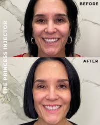 Sheree Jackson NP-C,MSN,BSN (@princessinjector.sheree) · Orlando, FL