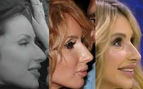 We did not find results for: Loboda Foto V Molodosti