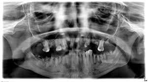 See full list on dentaly.org Management Of Drug And Alcohol Dependent Patients In Dental Practice