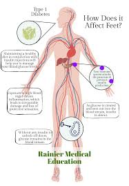 Foot and ankle online course: Controlling The Progression Of Diabetic Neuropathy With Nutrition