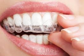 Para blanquear los dientes en casa, enjuágate la boca todos los días con una mezcla a partes iguales de agua común y agua oxigenada al 3% antes de lavarte los dientes. Como Blanquear Los Dientes En Casa Con Bicarbonoto O Limon