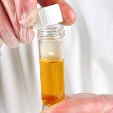 Infectious agents that cause hepatitis include viruses and parasites. Hepatitis Rechtzeig Erkennen Mit Labortests