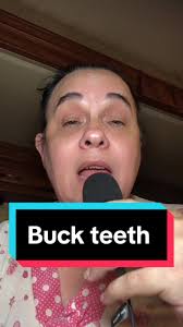 Buck teeth and gutters 💫 #storytime #funnystories #oralhistory  #funnyfamilymoments