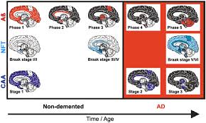 Nelson bonifacio acosta lópez, nicknamed pelado acosta (bald acosta), (born 12 june 1944 in paso de los toros, uruguay) is a former uruguayan footballer. View Of Neuropathology Of The Alzheimer S Continuum An Update Free Neuropathology