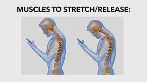 Maybe you would like to learn more about one of these? Hump On Back Of Neck Correct Bad Posture With Simple Steps