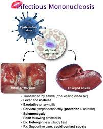 Rosh Review Pediatric Nursing Medical Mnemonics Pediatric Nurse Practitioner