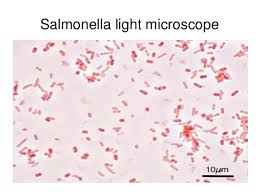 The genus salmonella, which belongs to the family enterobacteriaceae, was named after daniel e. Electron And Light Micrographs