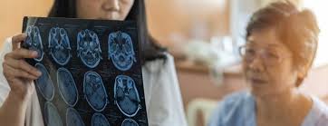 Image result for icd 10 code for focal seizure unspecified