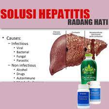 Pedih ulu hati dan sesak nafas. Obat Sakit Ulu Hati Dan Sesak Nafas Maxipack Izin Bpom Shopee Indonesia