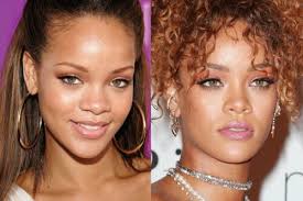 We did not find results for: Did Rihanna Have Plastic Surgery Quora
