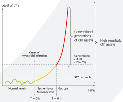 Trop t test actually tests the serum level of troponin t. Vidas High Sensitive Troponin I Biomerieux Clinical Diagnostics