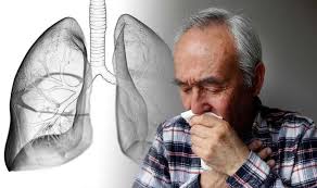 In the uk, for example, it is particularly high in cornwall. Lung Cancer Symptoms Recurring Chest Infections May Signal The Deadly Disease Express Co Uk