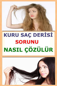 Kuru Sac Derisi Icin Etkili Bakim Kurleri Vipbakim Sac Sac Bakimi Sac Dokulmesi