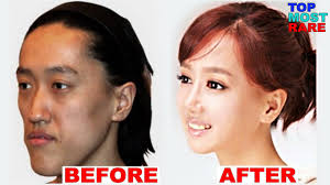 before and after plastic surgery clinic ile ilgili görsel sonucu