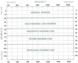 How to read an audiogram. How To Read Your Audiogram Results