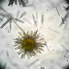 De ce apare acest dezechilibru al florei saprofite? Examen Sumar De Urina Bioclinica