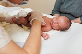 Image result for Neonatal Circumcision
