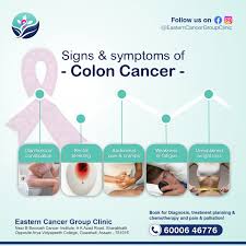 Image result for Constipation in Cancer