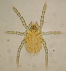 Image result for Trombicula autumnalis