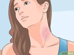 Its can be dermatitis share me some more details details consult online. How To Spot Contact Dermatitis Symptoms 9 Steps With Pictures