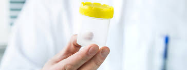 Artificial Insemination - Wikipedia