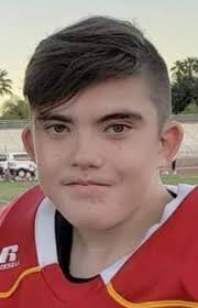 Living with digeorge syndrome in south florida