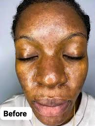 I know how paínful ménstruátion can be , and I sincerely feel sorry for  every lady. 🥺 May u not see ur periød this month🤣🏃🏽‍♀️