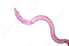 Image result for Beef Tapeworm