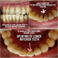 We did not find results for: Puresmiles Dental Clinic Home Facebook