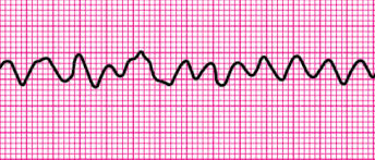 Acls Pre-Course Assessment Questions Flashcards | Quizlet