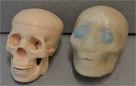 More and more patients are undergoing mri for spinal trauma in the emergency settings, thus necessitating the. A Realistic Phantom Of The Human Head For Pet Mri Ejnmmi Physics Full Text