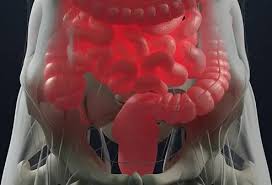 Image result for hemoroid human