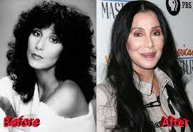 Size acceptance, body positivity, and fat activism are now part of the cultural lexicon, yet according to data f. Cher Plastic Surgery Just Too Much Of Procedures