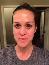 ✨ Shine Your Skin in Just 7 Days! ✨ Get rid of acne, dark spots & dullness  with Derma Clean Pink Fluid Whitening Face Wash 💧💖 Feel the glow, feel  the confidence!