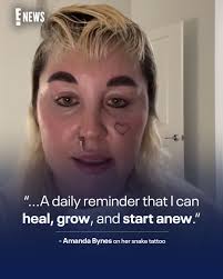 What a girl wants? A tattoo, according to Amanda Bynes. 🐍 More