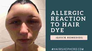 Hair dyes, like many other products, contain a number of chemicals that can irritate your skin. How Long Does An Allergic Reaction To Hair Dye Last