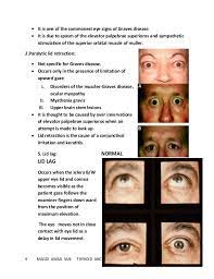 Pin On Thyroid Disease Home Remedies Treatment