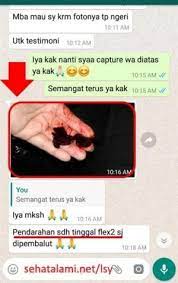Gumpalan darah saat menstruasi terdiri dari campuran sel darah, protein dalam darah serta jaringan dari lapisan rahim. Lsy Endo 2 Gerai Herba