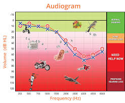 Understanding Your Audiogram Australian Audiology Gold