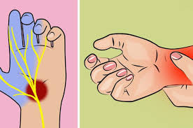 Check spelling or type a new query. Dari Keracunan Hingga Hiv Inilah 5 Penyakit Yang Bisa Dideteksi Dari Rasa Kesemutan