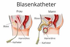 Blasenkatheter Dauerkatheter Blase Wann Ist Er Notwendig
